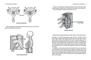 Sample content 3_Safe Movement for All Spines