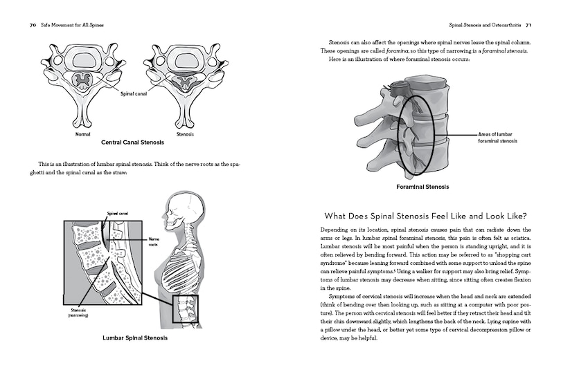 Sample content 3_Safe Movement for All Spines