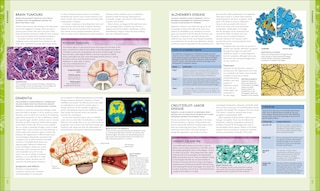 Aperçu du contenu_The Human Brain Book